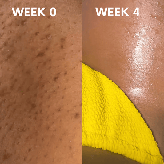 Dark Spot Lightening Mask without Bleaching | Suitable for Private Areas