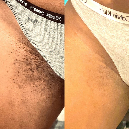Dark Spot Brightening Cream without Bleaching | Suitable for Private Areas